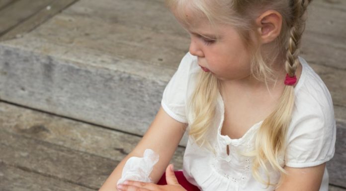 Ατοπική δερματίτιδα στα παιδιά: Φυσικοί τρόποι αντιμετώπισης